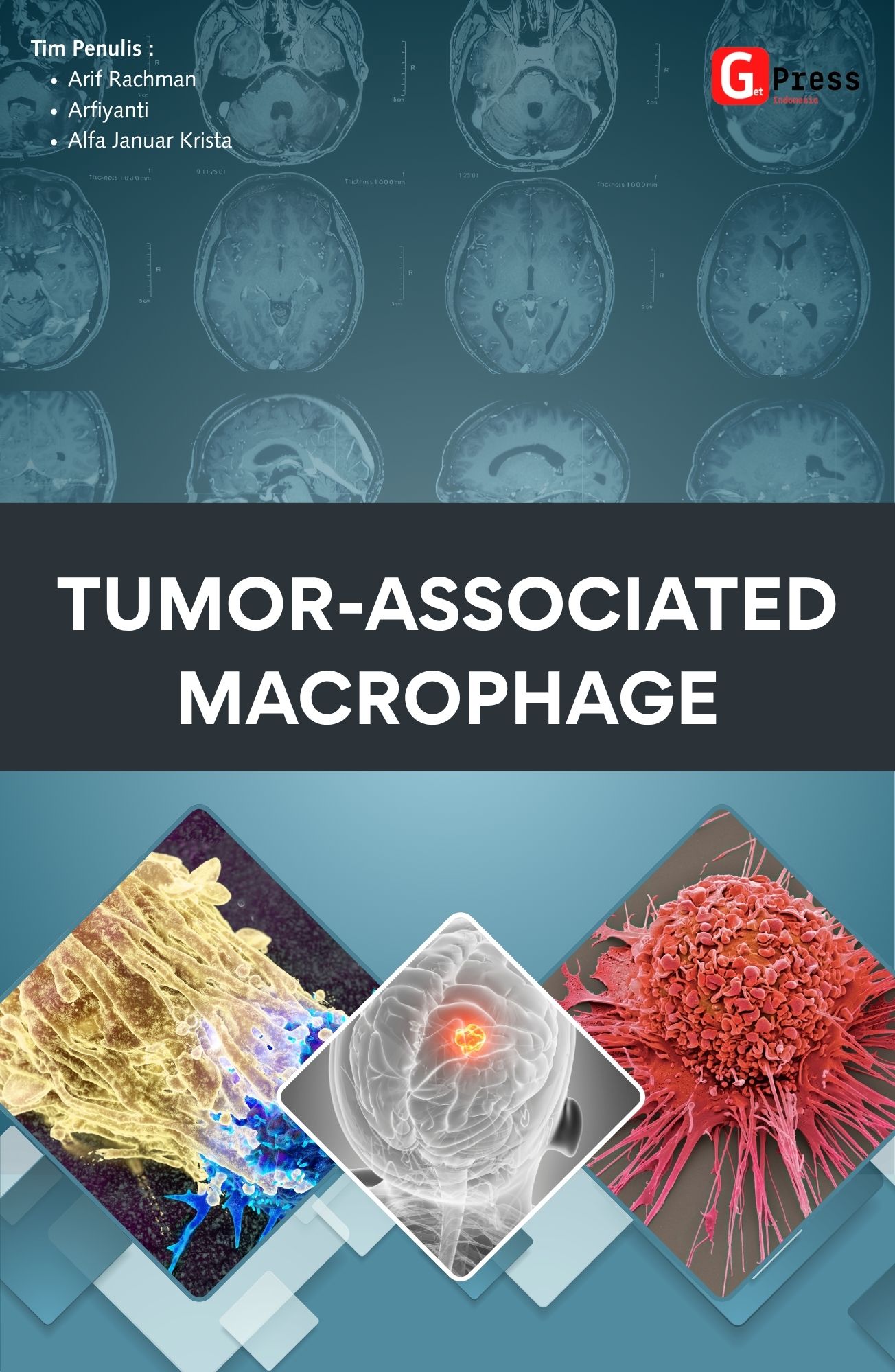 Tumor-Associated Macrophage
